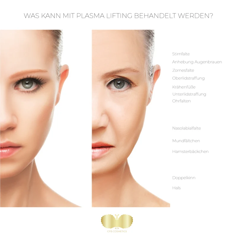 PlasCom® Plasma Pen Gerät für Hautstraffung & Verjüngung CFB Cosmetics®