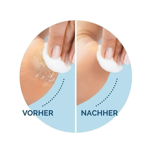 Scholl Velvet Smooth Nachfüller Wet&Dry - Extra Stark mit Diamantpartikeln