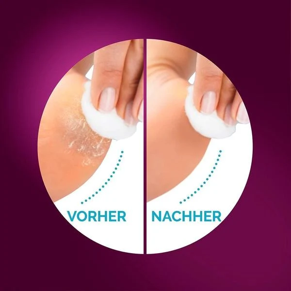 Scholl Velvet Smooth Pro Elektrischer Hornhautentferner