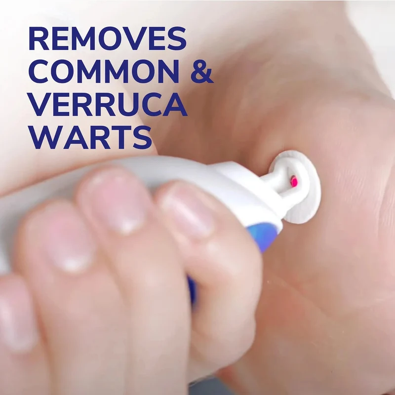 Freeze Away Max Verruca and Wart Remover for Hands and Feet