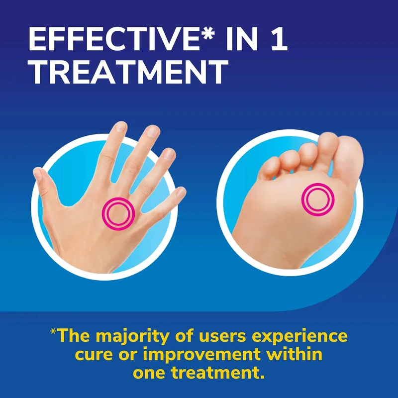 Freeze Away Max Verruca and Wart Remover for Hands and Feet