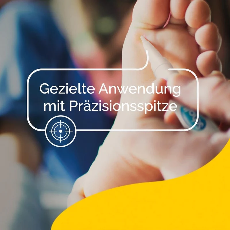Scholl Warzen & Dornwarzen Behandlungsstift, 2g