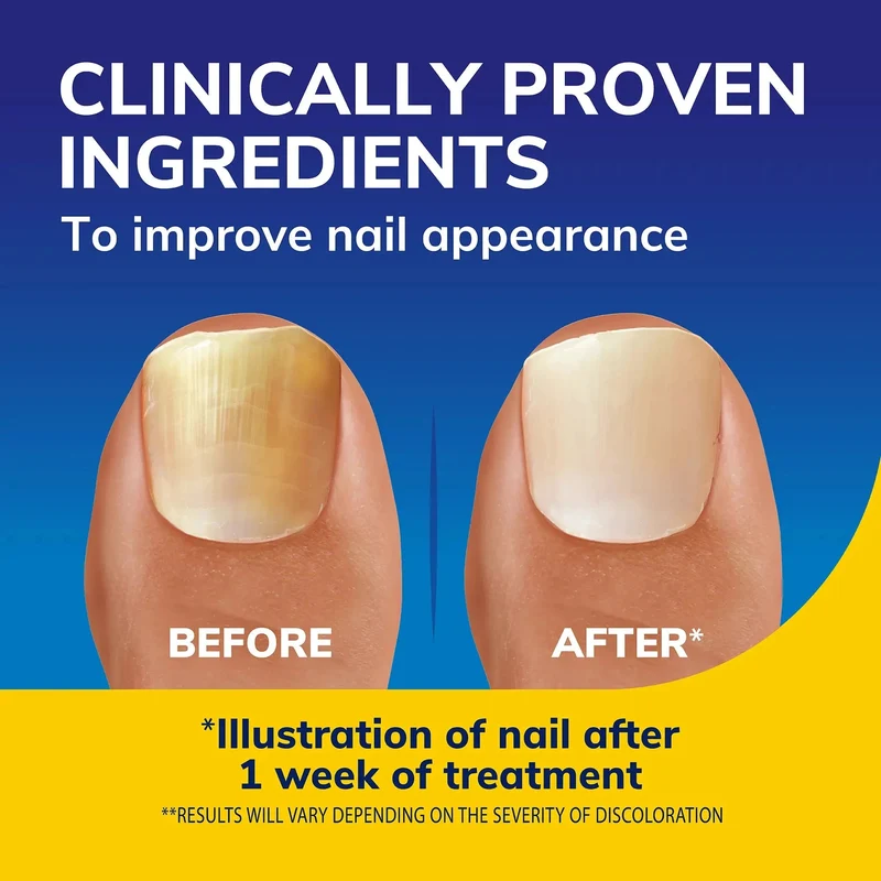 Nail Revitaliser Serum 10ml
