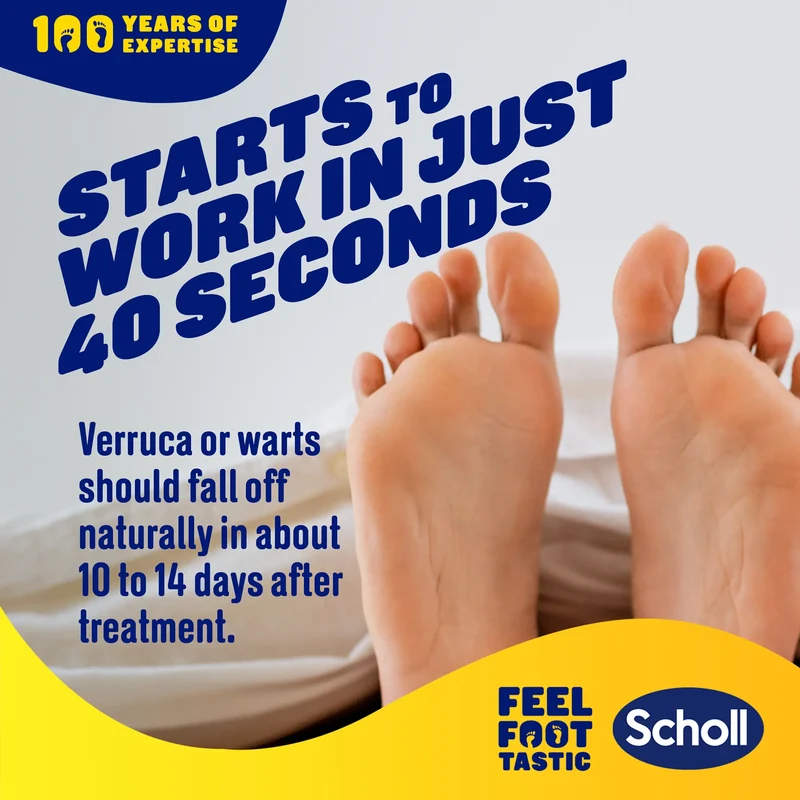 Wart Verruca Freeze Treatment
