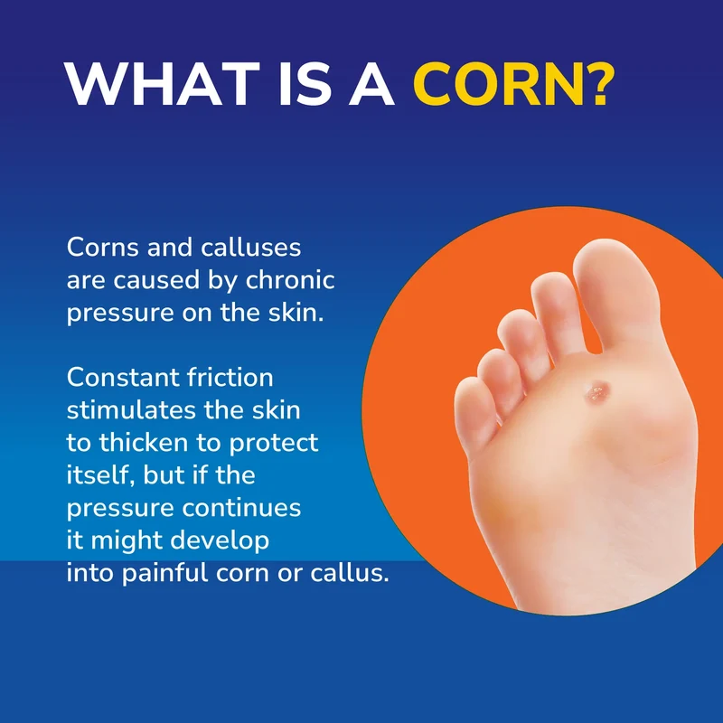 Corn Complete Removal Pen
