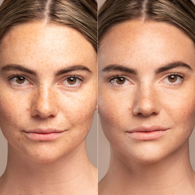 IMAGE Prevention+ sun serum SPF 30