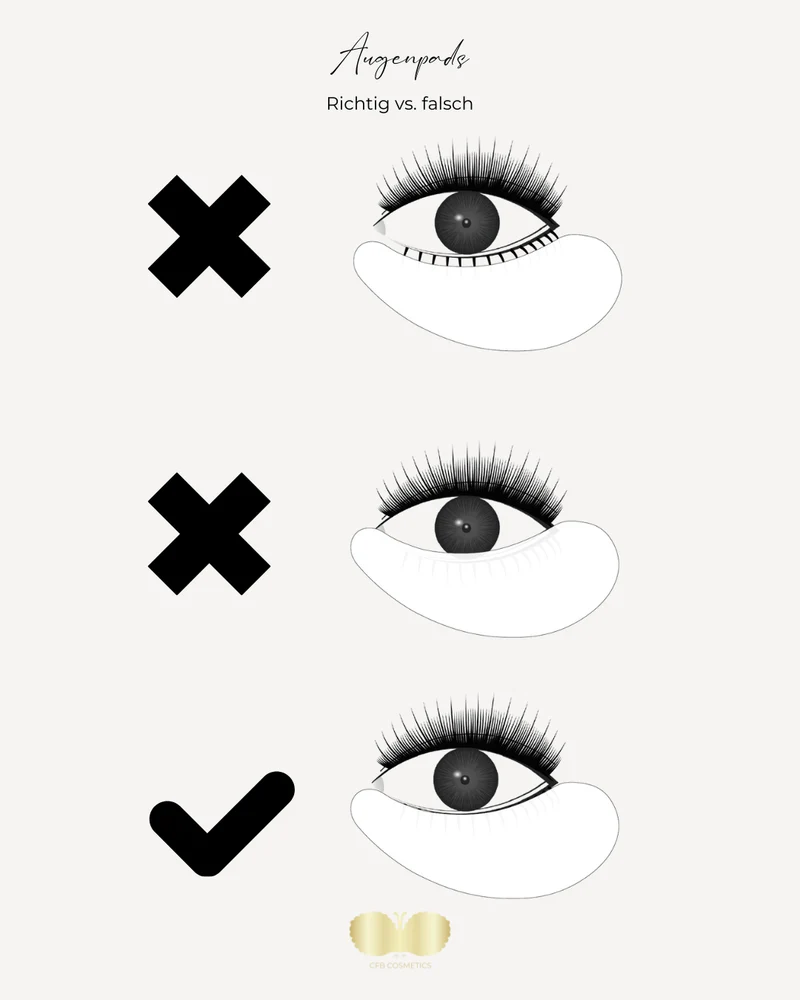 Augenpads | Typ Standard | 10 Paar | BESTSELLER