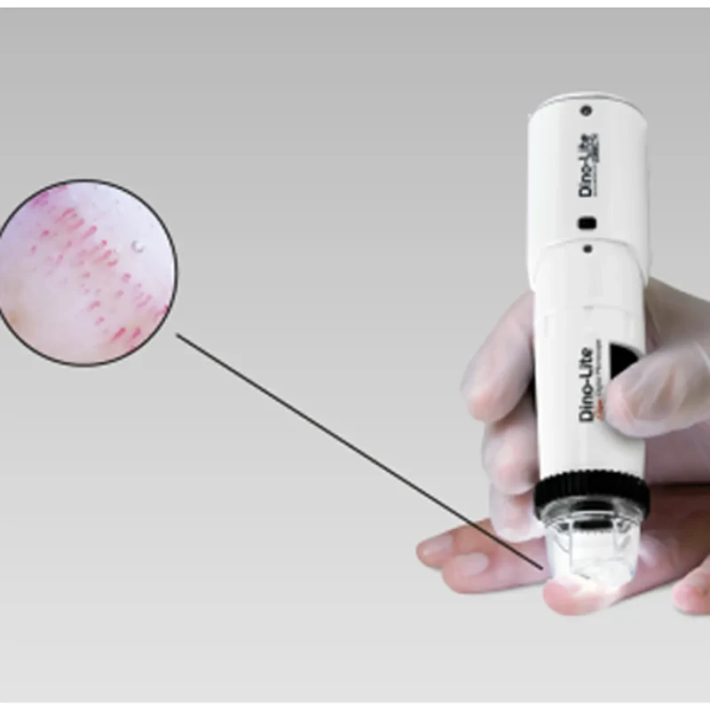 CapillaryScope 200 Pro (kabellos)