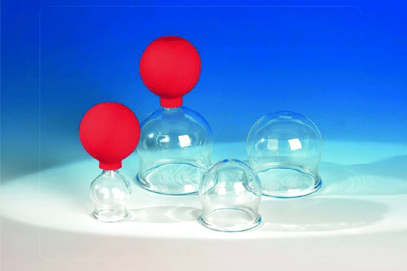 Schröpfgläser aus Glas zum Feuerschröpfen