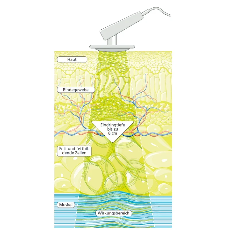DEEP OSCILLATION® Personal Basic