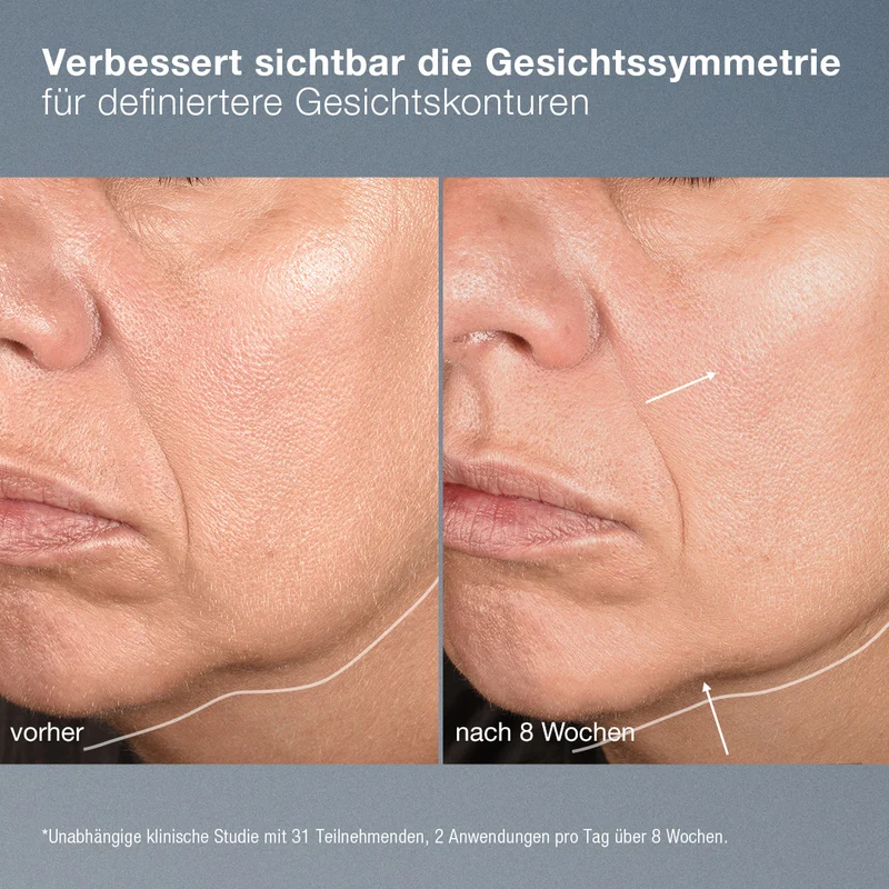 Dermalogica NeuroTouch Symmetry Serum 30ml