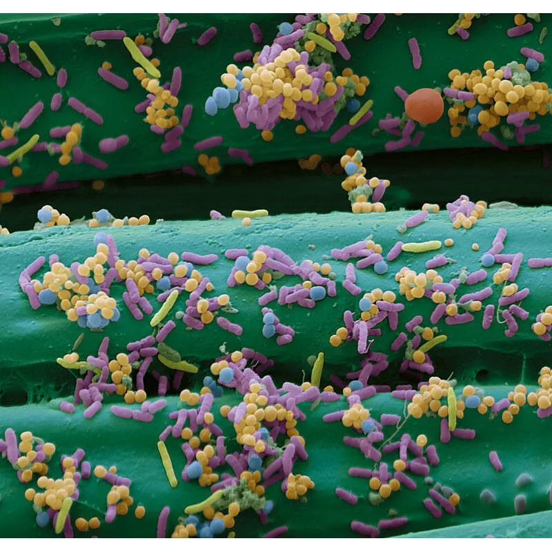 Cutimed Sorbact, Saugkomp.,antimikrobielle Wundauflage,steril