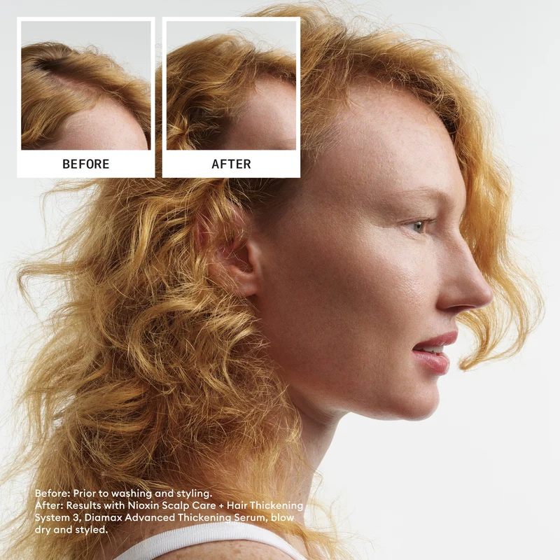 Nioxin System 4 Treue-Kit