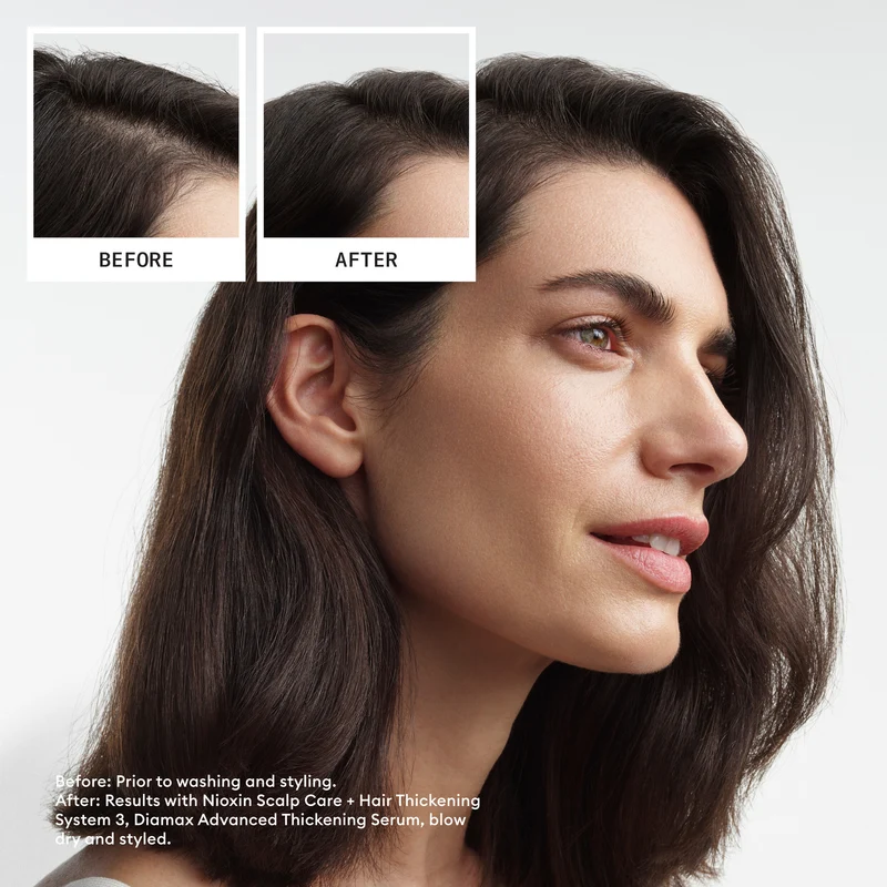 Nioxin System 3 Treue-Kit