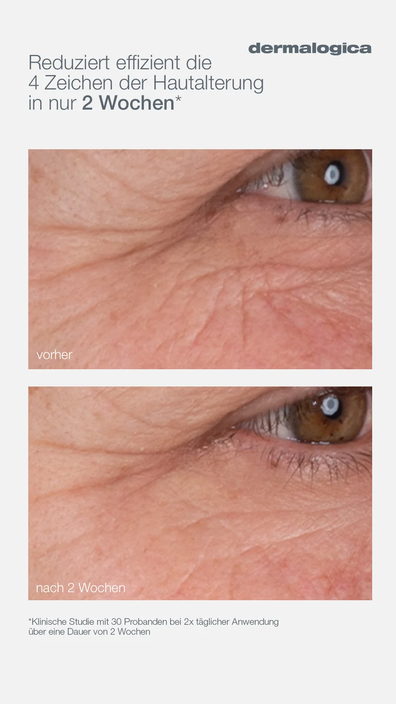 Dermalogica Dynamic Skin Retinol Serum