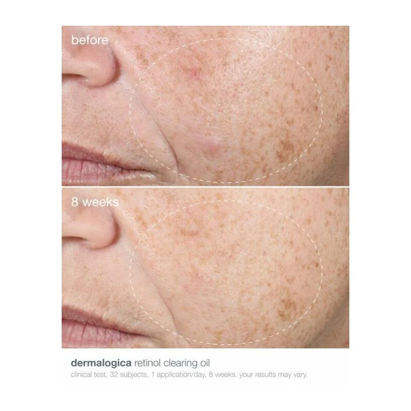 Dermalogica Retinol Klärungsöl 30 ml
