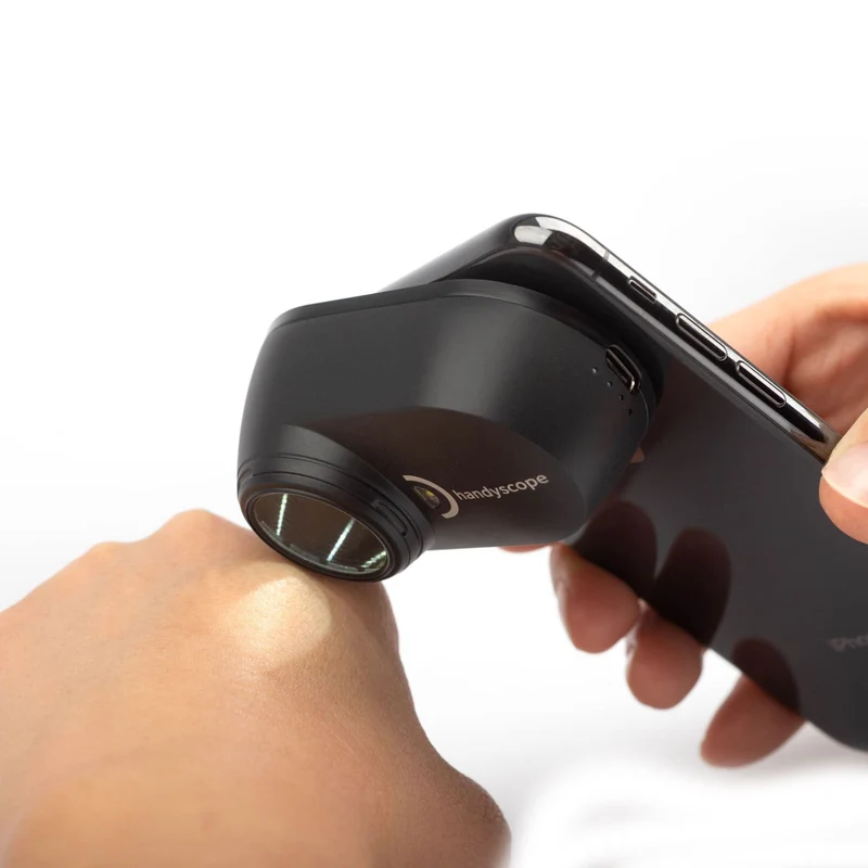 DermLite Handyscope