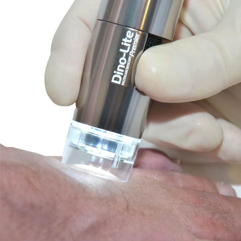 Dino-Lite PodoScope